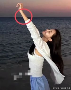 ▲汪小菲疑似與張穎穎互毆，使女方身上有多處瘀青。（圖／翻攝自微博《這個唐僧愛吃娛》）