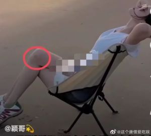 ▲汪小菲疑似與張穎穎互毆，使女方身上有多處瘀青。（圖／翻攝自微博《這個唐僧愛吃娛》）