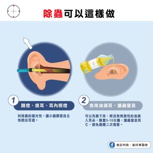 除蟲正確方法,可以減少對耳朵的傷害。 ▲除蟲正確方法,可以減少對耳朵的傷害。