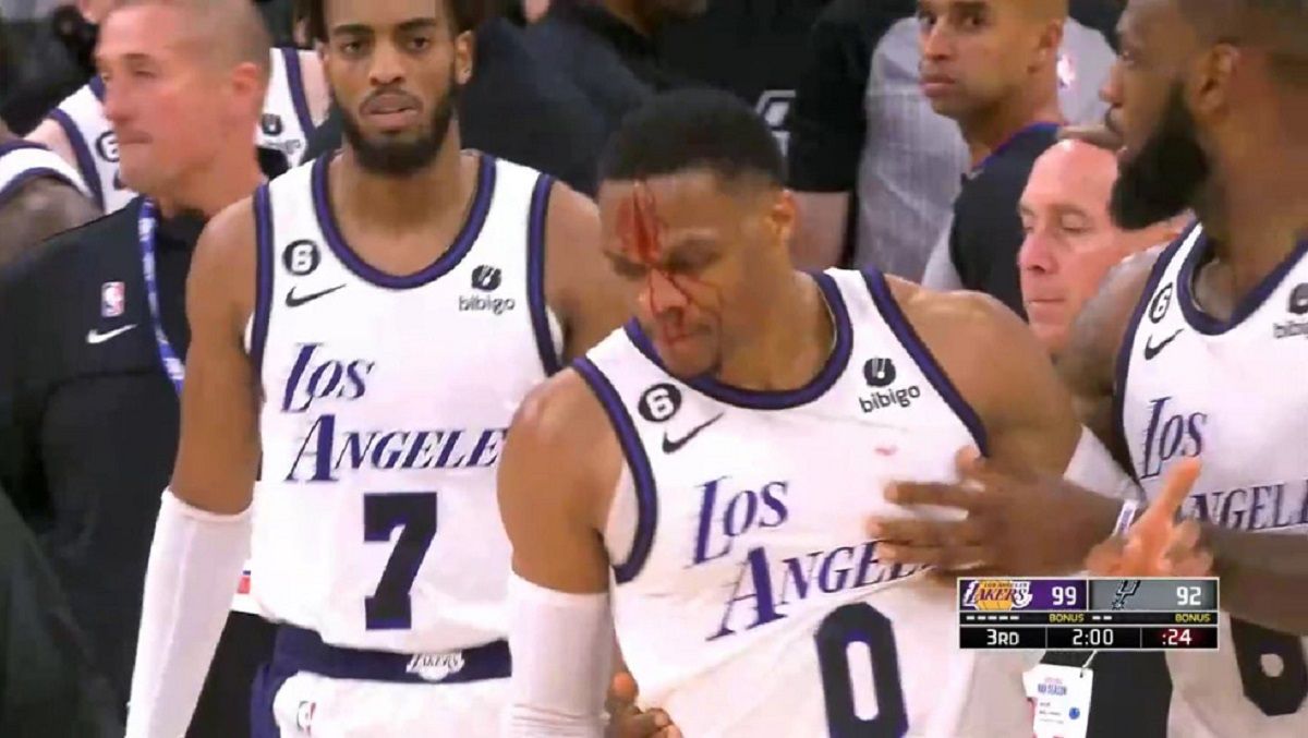 ▲「威少」Russell Westbrook被打中臉部流血。（圖／翻攝自YouTube）