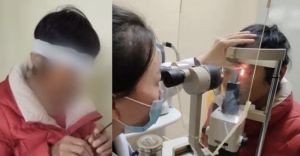 武漢女子重度近視3000度　手術無效被迫摘除眼球
