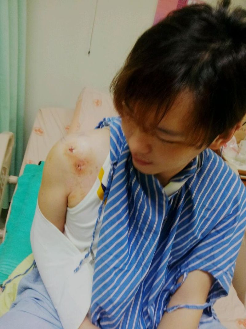 ▲安格斯熱愛各種運動，曾因打棒球導致右肩肩盂唇撕裂。（圖／翻攝自安格斯FB）