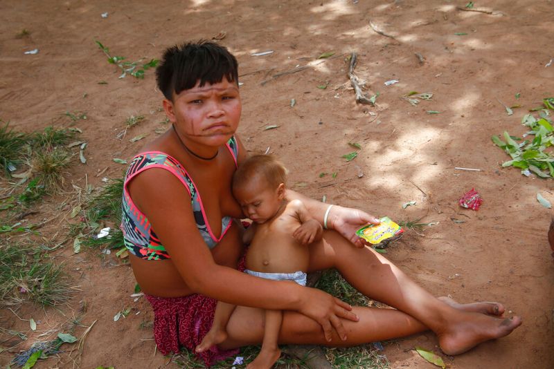 ▲巴西衛生部原住民衛生保健部門數據顯示，自2015年以來，亞諾馬米（Yanomami）原住民族5歲以下的兒童中，約有半數兒童的體重低於標準。（圖／美聯社／達志影像）