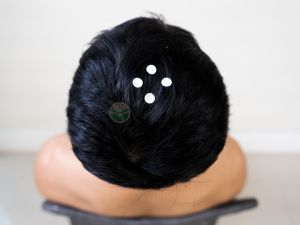 ▲可按摩四神聰穴等穴道,幫助緩解疲勞症狀。(圖/馬光中醫診所提供) ▲可按摩四神聰穴等穴道,幫助緩解疲勞症狀。(圖/馬光中醫診所提供)