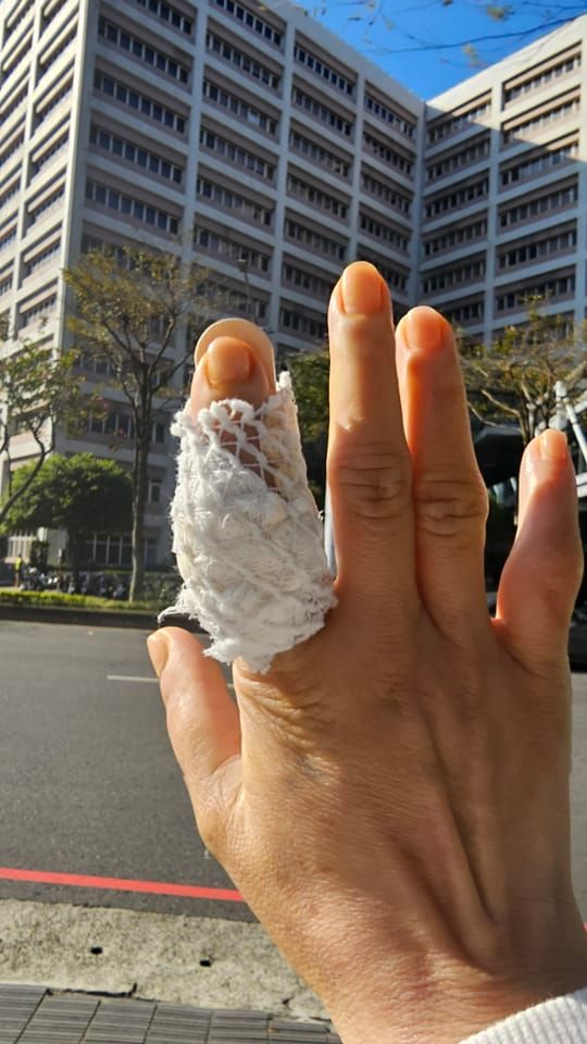 ▲王瑞玲表示，她手指肌腱斷裂，上禮拜已經做完第6次重建手術，目前正在休養中。（圖／翻攝王瑞玲FB）