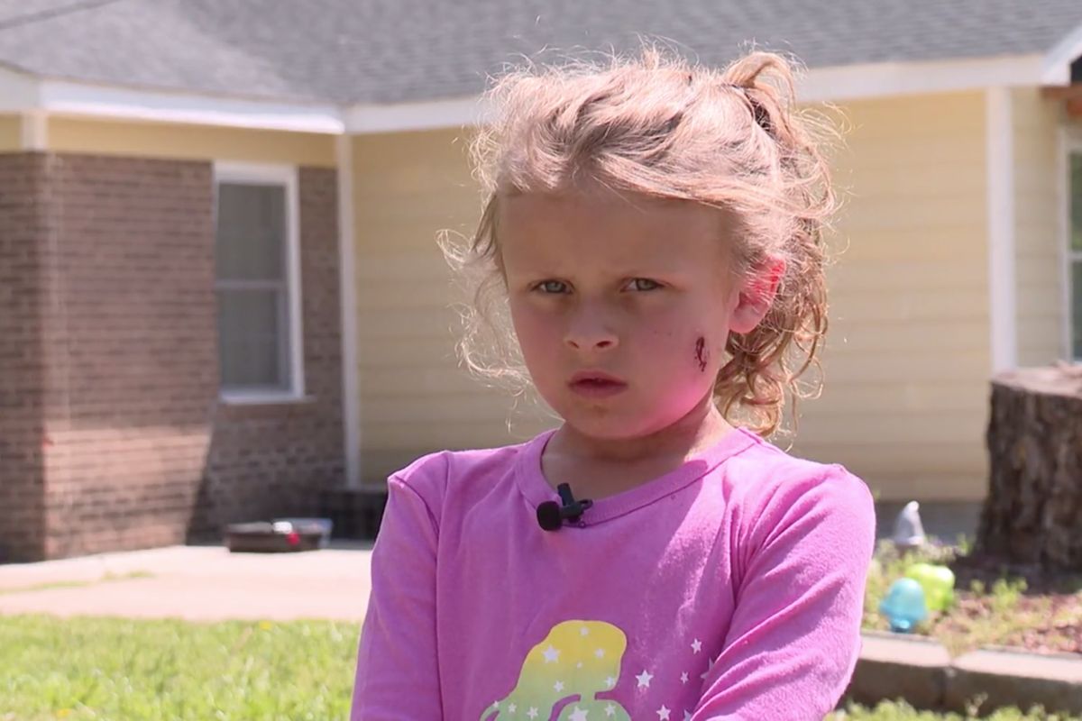 ▲北卡羅萊納州一位6歲女童金斯利 (Kinsley) ，18號在家玩球時不慎讓球滾進鄰居家院子，結果鄰居竟開槍朝金斯利父女射擊，金斯利臉頰被子彈擦過，父親則是背部中彈住院。（圖／翻攝自QueenCityNews的影片截圖）