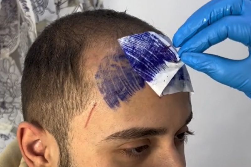 ▲義大利26歲男子為遮髮際線而刺青瀏海。（圖／TiKTok：gipsygtattooer）