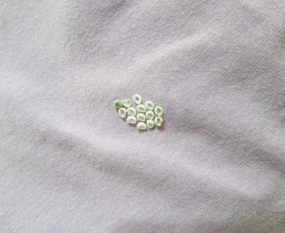 ▲網友發現衣服上面有奇怪的蟲卵，上網請益這是什麼東西，引起熱議。（圖/爆廢公社）