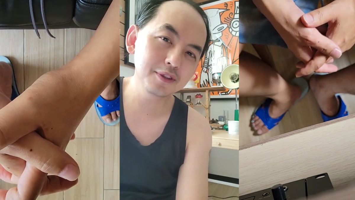 ▲藝人黃子佼遭網紅Zofia指控性騷，今發出「3段影片」道歉並毀滅式發言，並露出自己掉髮禿頭模樣。（圖／翻攝畫面）