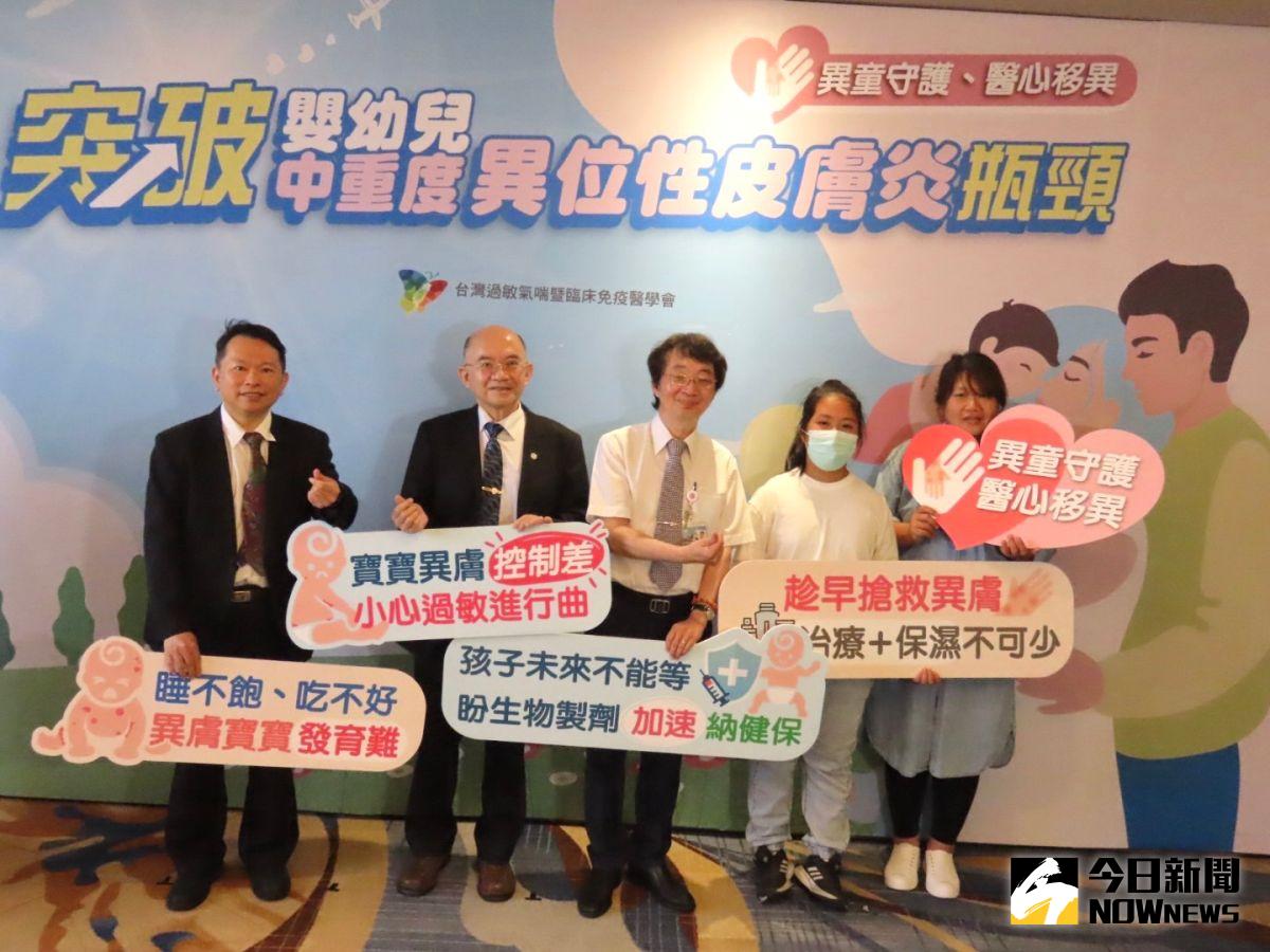 ▲12歲異膚女童，臉腫破皮流血遭罷凌，今天與兒科醫師站出來呼籲：放寬健保給付用藥。（圖／記者金武鳳攝，2023.6.29)