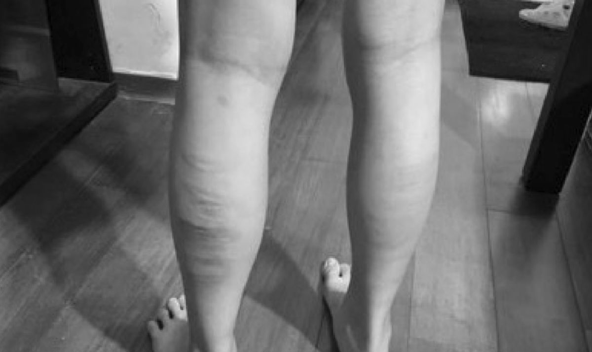 ▲新北市某國小五年級女童，因考試考了第5名，竟遭父親拿藤條抽小腿體罰，還將體罰過程PO臉書，引發網友議論，目前家防中心與教育局已介入調查。（圖／翻攝爆廢公社） 