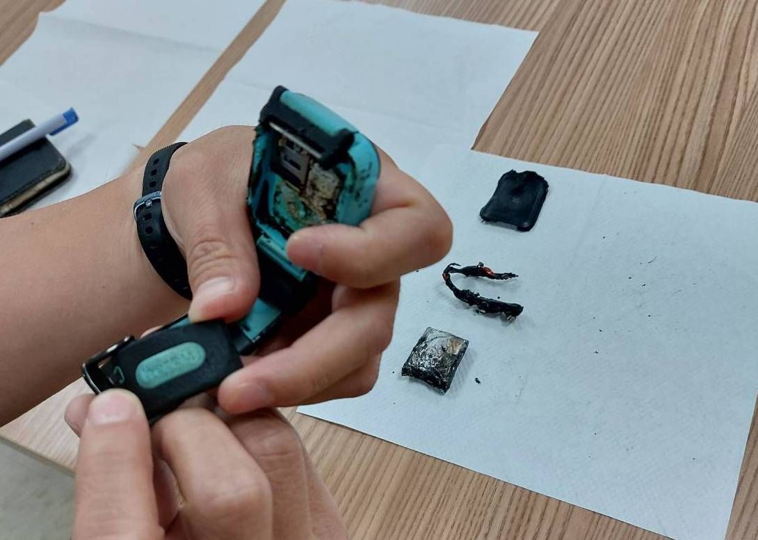 ▲近日有學童使用兒童智慧手錶爆炸，導致男童二度燒燙傷，甚至後續還需植皮治療。（圖／新北市主任消保官王治宇提供）