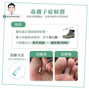 ▲毒襪子症候群就是「足蹠蠹蝕症」,是因一些存在於腳上的棒狀桿菌或微小球菌繁殖後會產生蛋白酶,分解腳皮所產生的洞,因此腳掌會看起來一個洞一個洞。(圖/陳昱璁皮膚科醫師授權使用) ▲毒襪子症候群就是「足蹠蠹蝕症」,是因一些存在於腳上的棒狀桿菌或微小球菌繁殖後會產生蛋白酶,分解腳皮所產生的洞,因此腳掌會看起來一個洞一個洞。(圖/陳昱璁皮膚科醫師授權使用)