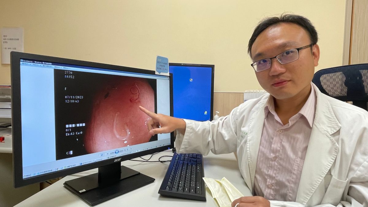 ▲醫提醒，民眾到野外務必穿鞋，降低鉤蟲入侵體內的風險(圖／醫院提供2023.7.18)