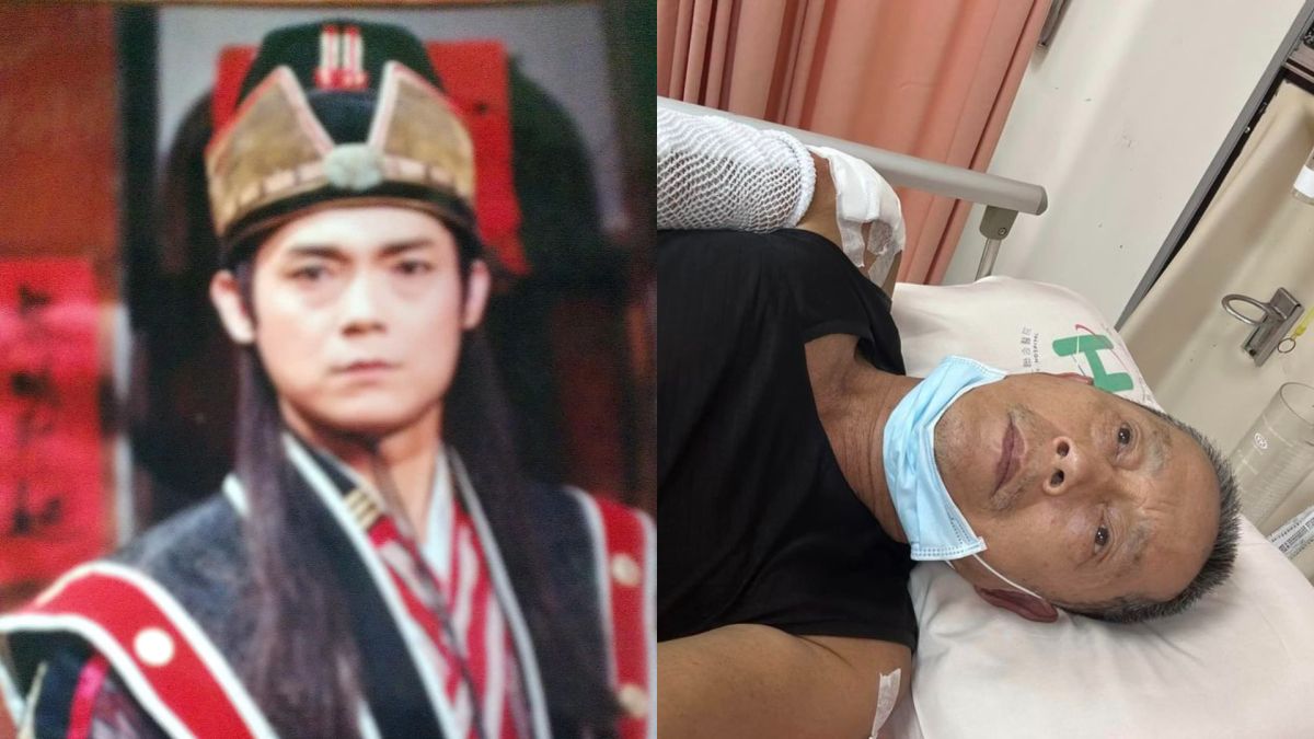 ▲67歲資深男星鄭平君，曾演過多部經典台灣戲劇，今日卻驚傳車禍送醫，手腳纏滿繃帶的傷勢，讓粉絲們相當心疼。（圖／鄭平君FB）