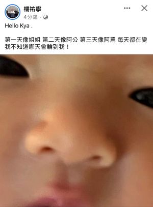 ▲楊祐寧曬女兒Kya的可愛臉蛋。（圖／翻攝楊祐寧臉書）