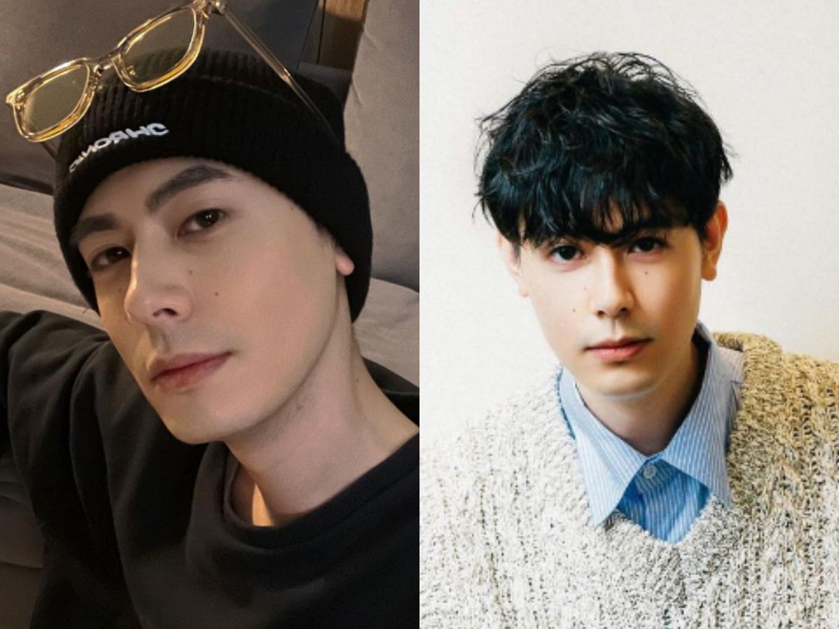 ▲前男團SpeXial成員Teddy（陳向熙）衰捲餐酒館鬥毆，臉蛋破相濺血。（圖／Teddy IG）