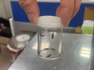 耳垢沒有清潔 耳內長蛆 嚇壞醫師