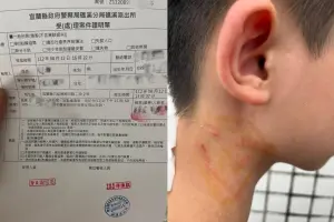 13歲男童在更衣間換衣服,出來時突然遭到一名成年男子衝進去毆打,導致頸脖、身體多處擦挫傷。(圖/翻攝宜蘭知識+) ▲13歲男童在更衣間換衣服,出來時突然遭到一名成年男子衝進去毆打,導致頸脖、身體多處擦挫傷。(圖/翻攝宜蘭知識+)