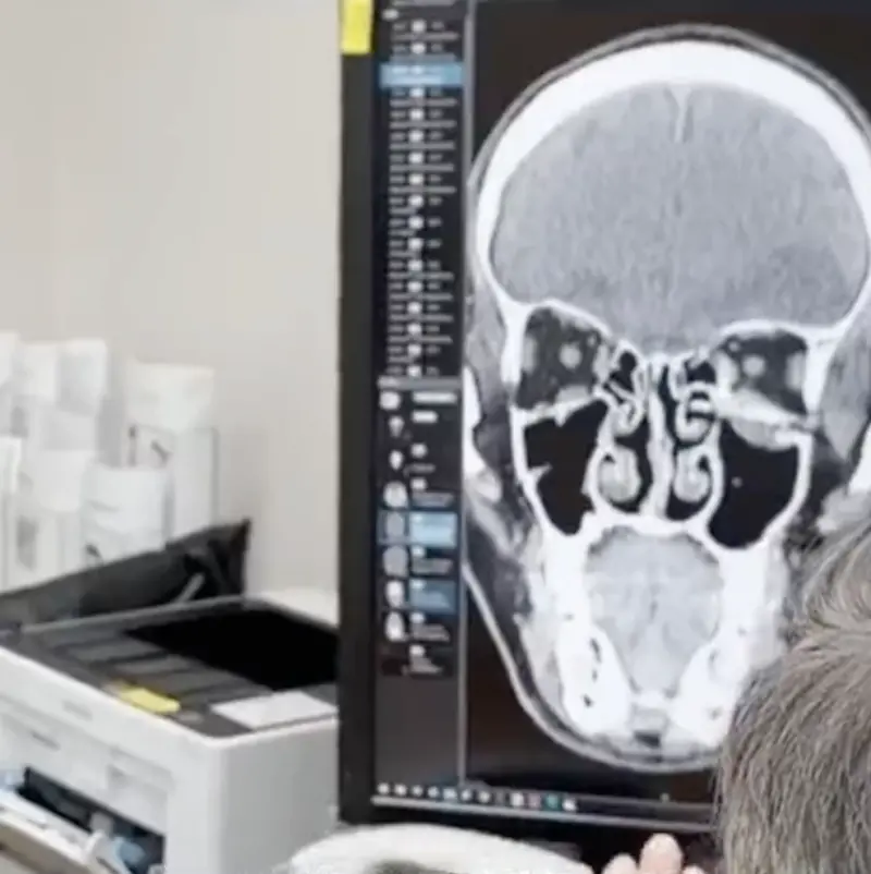 ▲林志穎車禍X光照首曝光。(圖/翻攝微博)