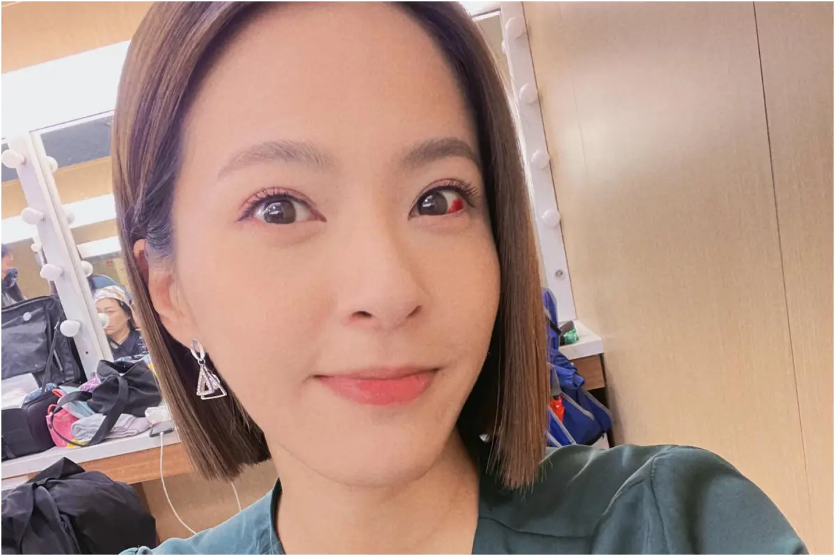 ▲蘇晏霈醒來眼睛感到灼熱刺痛，照鏡子發現左眼下方冒出紅色血塊，照片曝光怵目驚心。（圖 / 蘇晏霈臉書）