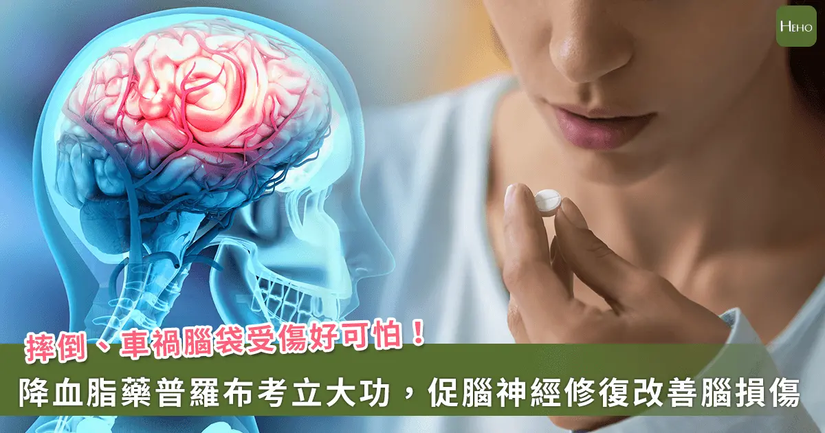 ▲車禍、獨居失足撞到腦損傷有救了！降血脂藥物普羅布考逆轉神經修復，避免失智