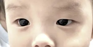 ▲男嬰停藥後5天眼睛又變回棕色，足見眼睛變色的原因跟「法匹拉韋」有關。（圖／frontiersin） 