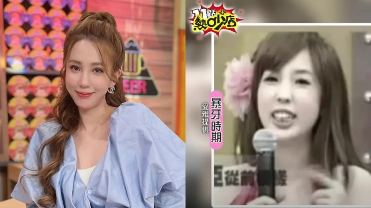 ▲愛雅曝光11年前的恐怖暴牙照片，透露她總共砸了60萬元去削骨、動正顎手術，雖然很痛苦，但如今的她不後悔。（圖／愛雅IG、《11點熱吵店》YouTube）