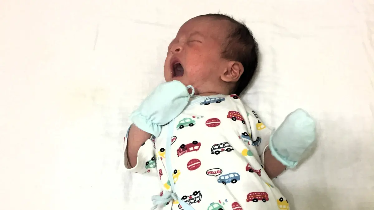 ▲台灣每10個小孩中，平均就有1例異位性皮膚炎，醫師建議睡覺時可以帶棉手套，提防搔癢抓到流血。（圖／記者黃韻文攝）