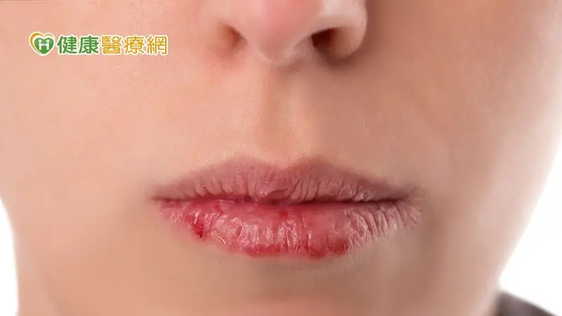 ▲嘴唇蒼白、鮮紅、發紫居然都不健康？　唇色意義大解密