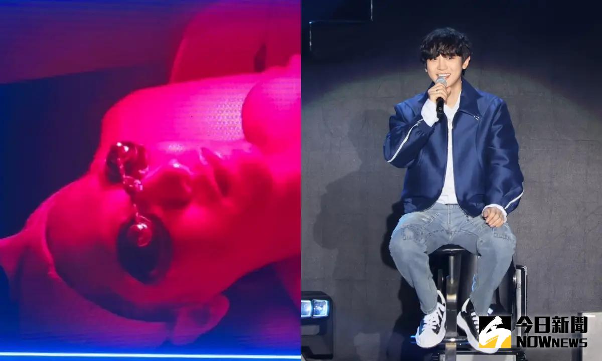 ▲EXO燦烈見面會上公開去看醫美的照片。（圖／記者鄭孟晃攝、讀者提供）