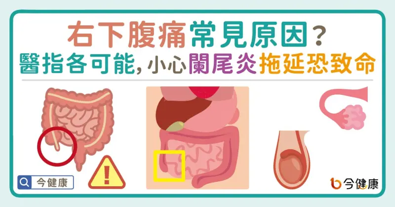 ▲右下腹痛常見原因？醫指各可能，小心闌尾炎拖延恐致命！