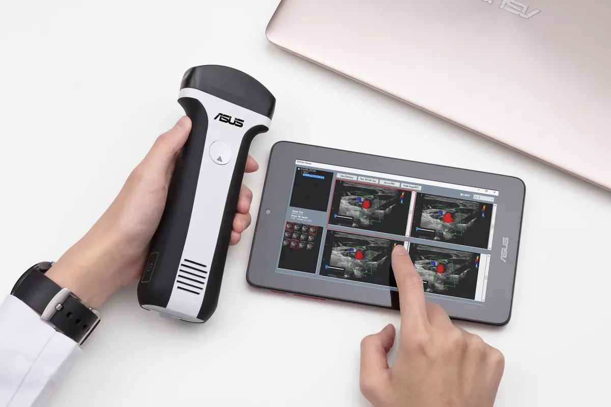 ▲華碩響應政府「邁向國際級偏鄉離島醫療與照顧」政策，日前捐贈22台手持超音波及100支智慧健康錶予15家醫療院所，協助建構智慧醫療環境。（圖／華碩提供）