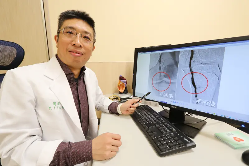 ▲醫師透過氣球擴張術打通阻塞血管後，大幅改善下肢冰冷情形。(圖／醫院提供2023.11.28)