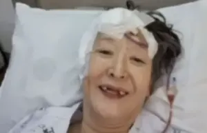 《上流戰爭》女星罹腦癌！不化療門牙掉光　67歲尹石花近況曝光
