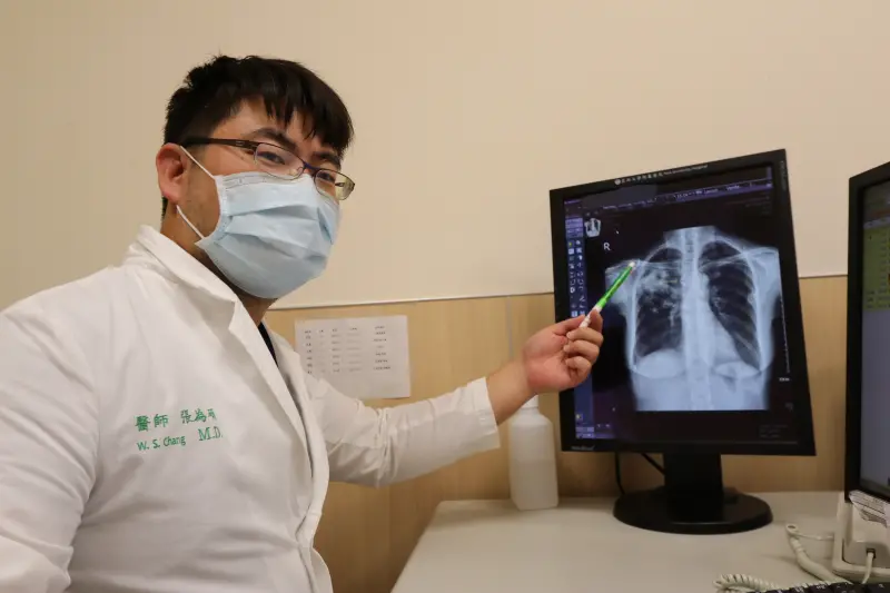 ▲患者X光檢查影像顯示右上肺葉發炎，宛如「開了一個洞」。(圖／醫院提供2023.12.5)