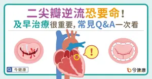 二尖瓣逆流恐要命，及早治療很重要！常見Q&A一次看
