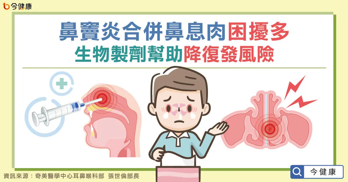 ▲鼻竇炎合併鼻息肉困擾多   生物製劑幫助降復發風險