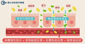 ▲「腸漏」（圖／聯安預防醫學提供）