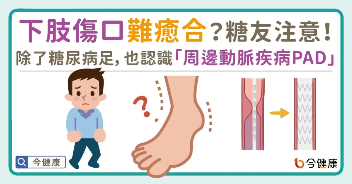 ▲下肢傷口難癒合？糖友注意！除了糖尿病足，你也該認識「周邊動脈疾病PAD」