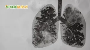 趙少康因父母肺癌病逝承諾當選「重視空污」　國健署：空污非唯一風險因子
