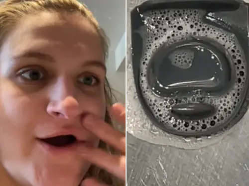 ▲Kae最後發現害自己生病的是水瓶裡發霉的矽膠片。（圖／翻攝IG@amelia.grace0）