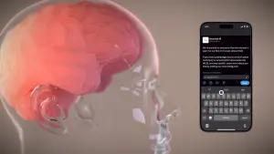 Neuralink成功將晶片植入人類大腦！馬斯克：想像霍金可快速溝通
