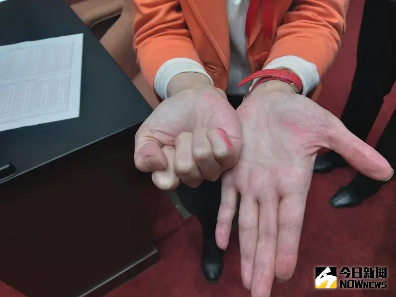 ▲民眾黨立委陳昭姿承認，投票筆沾有印污污染手指及選票，導致被主席認定為廢票。（圖／翻攝自陳昭姿臉書）