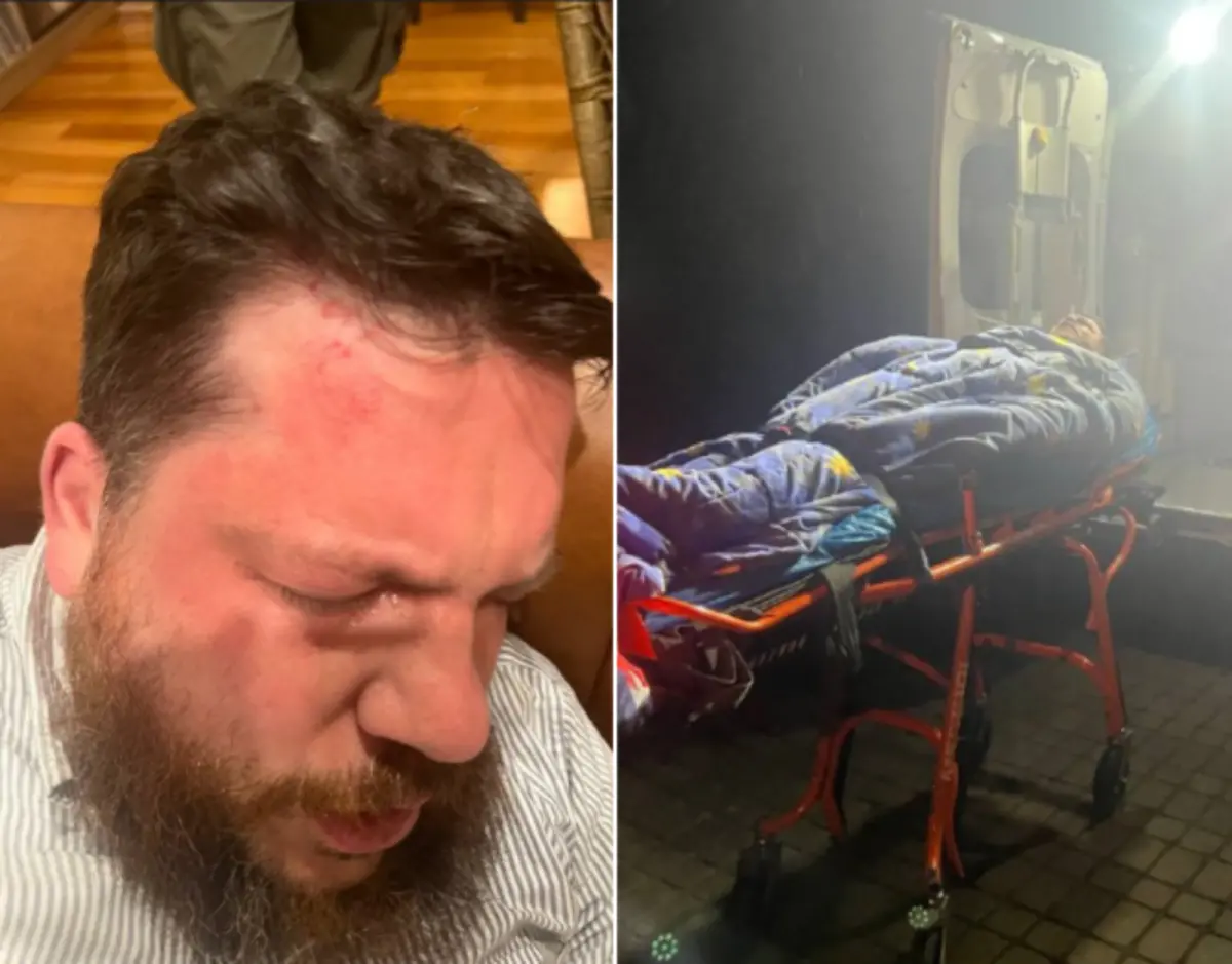 ▲俄國反對派領袖納瓦尼的前幕僚兼好友沃科夫（Leonid Volkov，圖），在立陶宛的住家外遇襲，多處受傷送醫。（圖／翻攝自Global News）