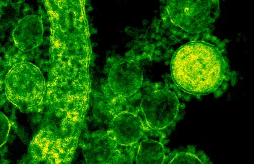 米酵菌酸是什麼？醫揭「無差別攻擊」：全面性細胞死亡
