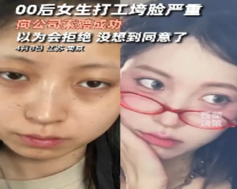 ▲中國南京近日有1名20多歲的女子，在網路上曝光自己因工作壓力大導致顏值下降，向公司索賠1萬元人民幣成功，引起討論。（圖／取自西部決策微博影片）