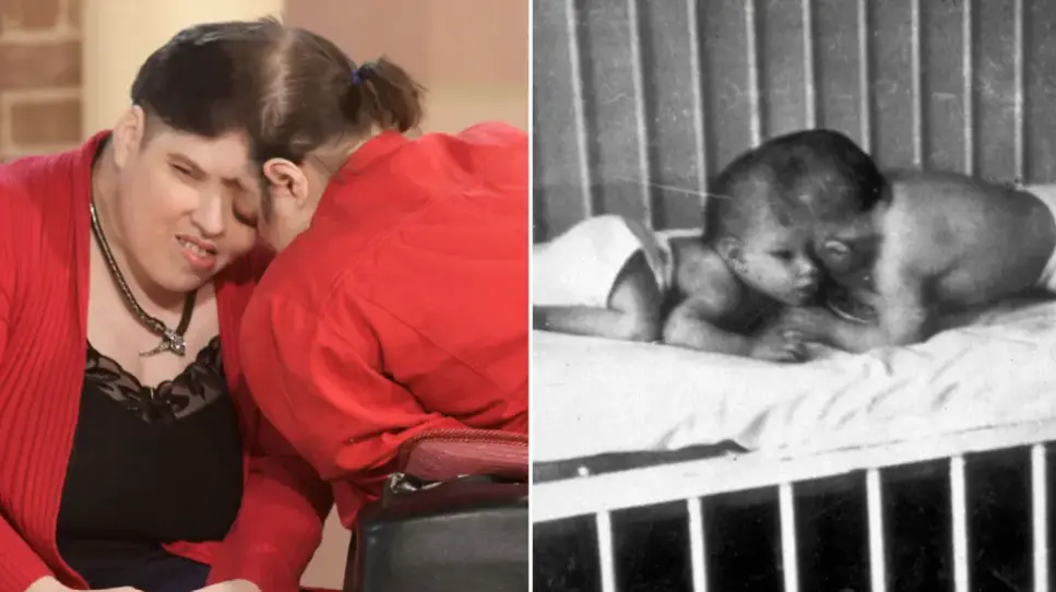 ▲美國最年長連體嬰Lori、George在4月7日過世，享壽62歲。（圖／翻攝自Guinness World Records）