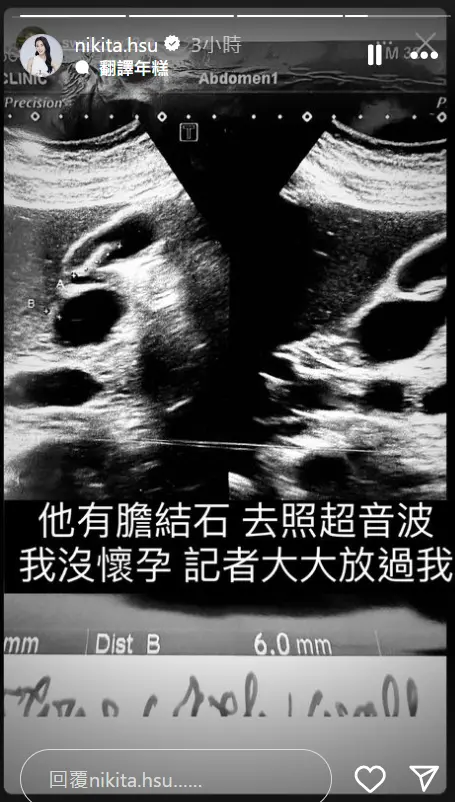 ▲舒子晨轉發老公的限時動態,表示沒有懷孕,請記者大大放過自己。(圖/舒子晨IG) ▲舒子晨轉發老公的限時動態,表示沒有懷孕,請記者大大放過自己。(圖/舒子晨IG)