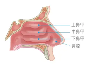 ▲男子為治療鼻塞，經手術切除部分下鼻甲，卻造成空鼻症，苦不堪言。（圖／翻攝網路）